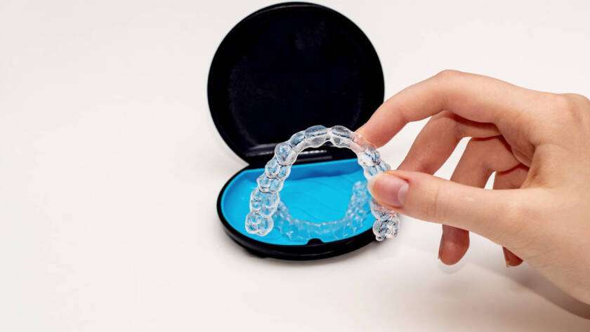 The Importance of Wearing a Retainer After Orthodontic Treatment