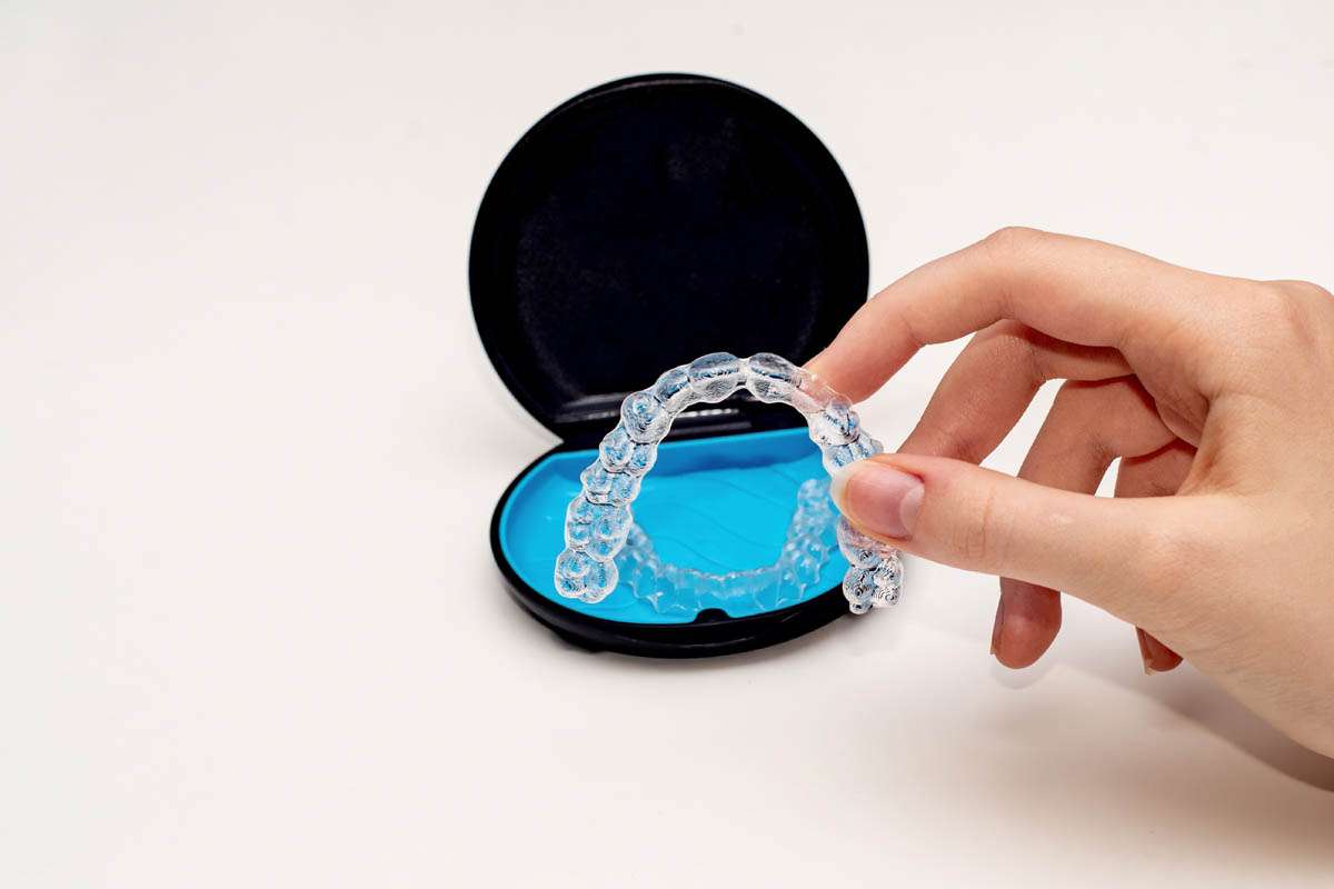 The Importance of Wearing a Retainer After Orthodontic Treatment